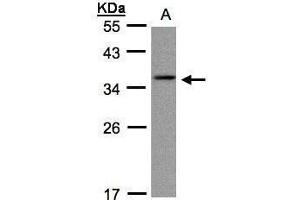 WB Image Sample(30 ug whole cell lysate) A:A431, 12% SDS PAGE antibody diluted at 1:1000 (CRYGC Antikörper)