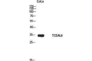 Western Blot (WB) analysis of CoLo using TCEAL6 antibody. (TCEAL6 Antikörper)