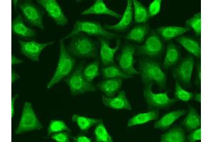 Immunofluorescence analysis of A549 cells using XRCC2 antibody (ABIN5970910). (XRCC2 Antikörper)