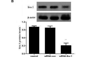 Western Blotting (WB) image for anti-Sulfiredoxin 1 (SRX1) (AA 45-137) antibody (ABIN1387599)