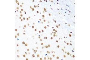 Immunohistochemistry of paraffin-embedded mouse brain using CTCF antibody at dilution of 1:100 (40x lens).
