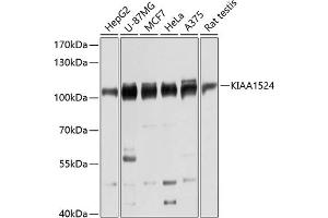 Western blot analysis of extracts of various cell lines, using KI antibody (ABIN6128778, ABIN6142850, ABIN6142851 and ABIN6215877) at 1:3000 dilution. (KIAA1524 Antikörper  (AA 681-905))