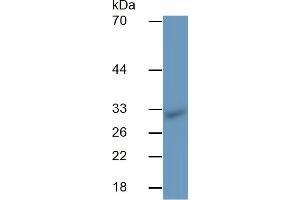 Western Blotting (WB) image for Interleukin 2 Receptor, alpha (IL2RA) ELISA Kit (ABIN6730938)