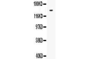 Anti- FLT1 antibody, Western blottingAll lanes: Anti VEGF Receptor 1  at 0. (FLT1 Antikörper  (N-Term))