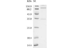 Aquaporin 4 (AQP4) (AA 1-323), (full length) protein (His tag)