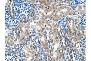 ABP1 antibody was used for immunohistochemistry at a concentration of 4-8 ug/ml to stain Epithelial cells of renal tubule (arrows) in Human Kidney. (DAO Antikörper  (C-Term))