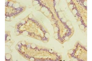 Immunohistochemistry of paraffin-embedded human small intestine tissue using ABIN7163860 at dilution of 1:100