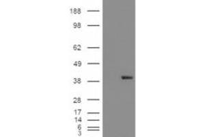 Western Blotting (WB) image for anti-Aldo-Keto Reductase Family 1, Member B1 (Aldose Reductase) (AKR1B1) antibody (ABIN5912019) (AKR1B1 Antikörper)