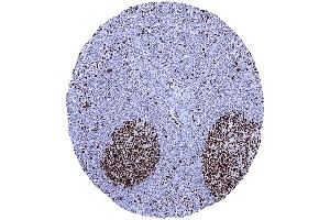In lymph nodes a particularly strong MCM7 staining occurs in most cells of germinal centres (Rekombinanter MCM7 Antikörper  (AA 195-319))
