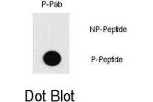 Dot blot analysis of MEF2C (phospho T20) polyclonal antibody  on nitrocellulose membrane. (MEF2C Antikörper  (pThr20))