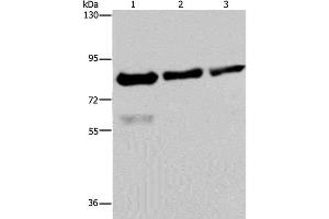 Western Blot analysis of Hela, LoVo and HepG2 cell using FASTKD2 Polyclonal Antibody at dilution of 1:500 (FASTKD2 Antikörper)