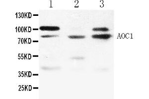 Western blot analysis of ABP1 expression in NRK whole cell lysates ( Lane 1), 293T whole cell lysates ( Lane 2) and MCF-7 whole cell lysates ( Lane 3). (DAO Antikörper  (N-Term))