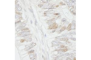 Immunohistochemistry (IHC) image for anti-Adenomatous Polyposis Coli (APC) (AA 1-50) antibody (ABIN7448412)