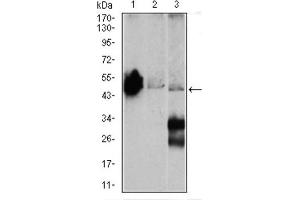 Western blot analysis using ENO2 antibody against Mouse brain (1), NIH3T3 (2), and C6 (3) cell lysate. (ENO2/NSE Antikörper  (AA 251-433))