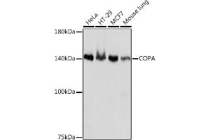 Western blot analysis of extracts of various cell lines, using COPA Rabbit mAb (ABIN7266423) at 1:1000 dilution. (COPA Antikörper)