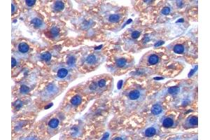 DAB staining on IHC-P; Samples: Rat Liver Tissue (FTH1 Antikörper  (AA 1-182))