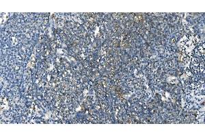 IHC analysis of Carbonic Anhydrase I/CA1 using anti-Carbonic Anhydrase I/CA1 antibody (ABIN7602620).