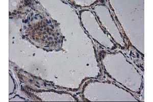 Immunohistochemical staining of paraffin-embedded Human thyroid tissue using anti-EIF4E2 mouse monoclonal antibody. (EIF4E2 Antikörper)