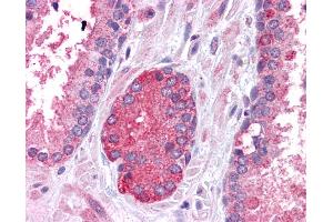 Immunohistochemistry (IHC) image for anti-Signal Transducer and Activator of Transcription 3 (Acute-Phase Response Factor) (STAT3) (N-Term) antibody (ABIN2780479) (STAT3 Antikörper  (N-Term))