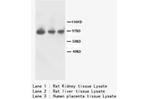 Image no. 2 for anti-Fibroblast Growth Factor Receptor 2 (FGFR2) (C-Term) antibody (ABIN1493068) (FGFR2 Antikörper  (C-Term))