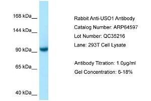 Western Blotting (WB) image for anti-USO1 Homolog, Vesicle Docking Protein (USO1) (C-Term) antibody (ABIN2789890)