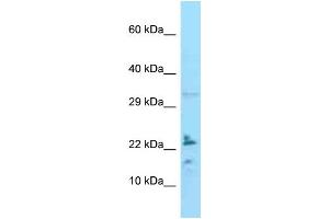WB Suggested Anti-IL24 Antibody Titration: 1. (IL-24 Antikörper  (C-Term))
