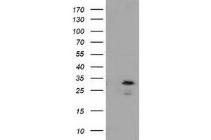 Western Blotting (WB) image for anti-RASD Family, Member 2 (RASD2) antibody (ABIN1500695) (RASD2 Antikörper)