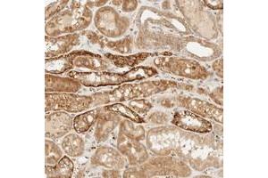Immunohistochemical staining of human kidney with KLF17 polyclonal antibody  shows strong cytoplasmic positivity in distal tubules at 1:200-1:500 dilution. (KLF17 Antikörper)