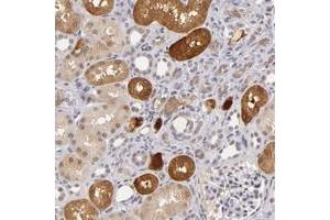 Immunohistochemical staining of human kidney with ZNF205 polyclonal antibody  shows cytoplasmic positivity in cells in tubules at 1:20-1:50 dilution. (ZNF205 Antikörper)
