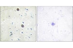 Immunohistochemistry analysis of paraffin-embedded human brain, using Amyloid beta A4 (Phospho-Thr743/668) Antibody.