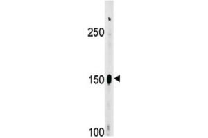 Western Blotting (WB) image for anti-C-Abl Oncogene 1, Non-Receptor tyrosine Kinase (ABL1) (pTyr412) antibody (ABIN3001744) (ABL1 Antikörper  (pTyr412))