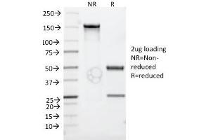 SDS-PAGE (SDS) image for anti-Tumor Necrosis Factor Receptor Superfamily, Member 8 (TNFRSF8) antibody (ABIN6941147)