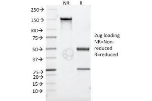 SDS-PAGE Analysis Purified CD30 Monoclonal Antibody (Ki-1/779). (TNFRSF8 Antikörper)