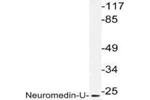 Western blot (WB) analysis of Neuromedin-U in extracts from HepG2 cells with AP21204PU-N. (Neuromedin U Antikörper)