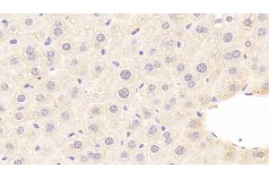 Detection of C8b in Mouse Liver Tissue using Polyclonal Antibody to Complement Component 8b (C8b) (C8B Antikörper  (AA 161-503))