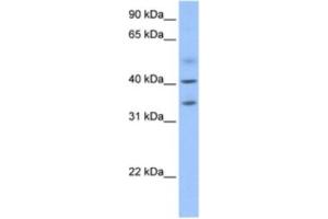 Western Blotting (WB) image for anti-Zinc Finger CCCH-Type Containing 14 (ZC3H14) antibody (ABIN2463623) (ZC3H14 Antikörper)