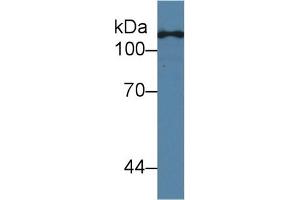 Western Blot; Sample: Human Hela cell lysate; Primary Ab: 2µg/ml Mouse Anti-Human TLR5 Antibody Second Ab: 0. (TLR5 Antikörper  (AA 693-858))