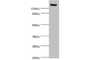 Western blot All lanes: SPAG5 antibody at 2 μg/mL Secondary Goat polyclonal to rabbit IgG at 1/10000 dilution Predicted band size: 134 kDa Observed band size: 134 kDa (SPAG5 Antikörper  (AA 1-300))
