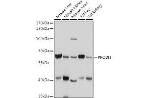 Western blot analysis of extracts of various cell lines, using PRODH antibody (ABIN6128506, ABIN6146242, ABIN6146243 and ABIN6221531) at 1:1000 dilution. (PRODH Antikörper  (AA 321-600))