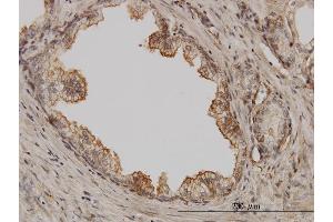 Immunoperoxidase of monoclonal antibody to PAK1 on formalin-fixed paraffin-embedded human prostate. (PAK1 Antikörper  (AA 191-280))