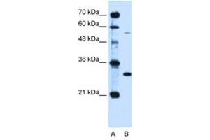 Image no. 2 for anti-Hemochromatosis (HFE) (AA 149-198) antibody (ABIN6736669) (HFE Antikörper  (AA 149-198))