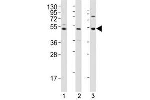 Western Blotting (WB) image for anti-Lymphocyte-Activation Gene 3 (LAG3) (AA 103-132) antibody (ABIN3028809)