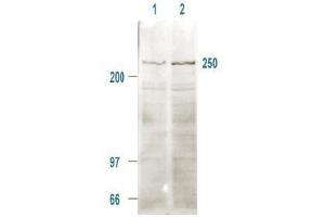 Immunoblotting. (MTOR Antikörper  (pSer2448))