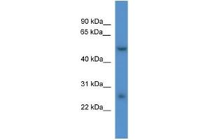 Rat Liver; WB Suggested Anti-Pigw Antibody Titration: 0. (PIGW Antikörper  (Middle Region))