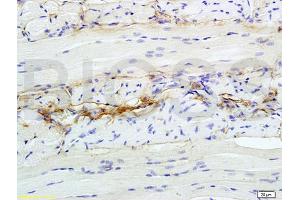 Formalin-fixed and paraffin embedded rat tongue tissue labeled with Anti-CD47 MER6 Polyclonal Antibody, unconjugated  (ABIN739530)  at 1: 200  followed by incubation with conjugated secondary antibody (CD47 Antikörper  (AA 241-323))