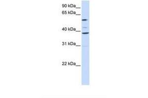 Image no. 1 for anti-Solute Carrier Family 25 (Mitochondrial Carrier, Graves Disease Autoantigen), Member 16 (SLC25A16) (AA 218-267) antibody (ABIN6738110)