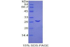 SDS-PAGE (SDS) image for Transmembrane Protein 173 (TMEM173) (AA 160-363) protein (His tag) (ABIN1877242)