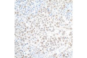 Immunohistochemistry (IHC) image for anti-PHD Finger Protein 8 (PHF8) (AA 650-700) antibody (ABIN7454781) (PHF8 Antikörper  (AA 650-700))