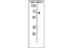 Western blot analysis of RXRB Antibody (Center) Cat. (Retinoid X Receptor beta Antikörper  (Middle Region))