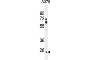 ZCCHC17 Antibody (Center) western blot analysis in A375 cell line lysates (35 µg/lane). (ZCCHC17 Antikörper  (Middle Region))